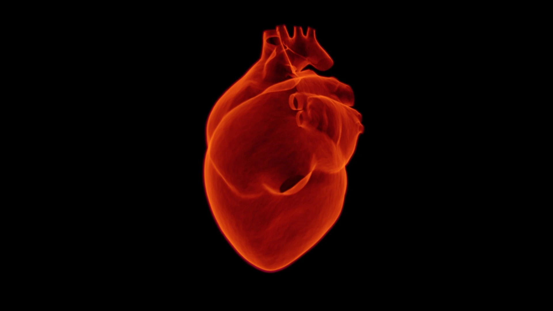 Cardiology – Atrial Fibrillation