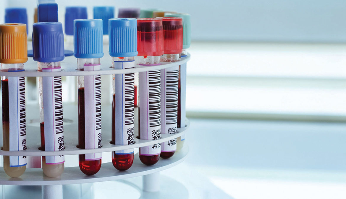 NWAFT Departmental Advice for Common Haematological Abnormalities